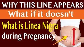 What Dark Line That Appears During Pregnancy Tells | What is Linea Nigra and Linea Alba