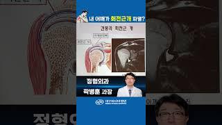 내 어깨가 회전근개 파열??? -대구파티마병원 정형외과 곽병훈 과장 #대구파티마병원 #회전근개