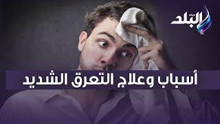 الدكتور حسام موافي يكشف أسباب وعلاج التعرق الشديد