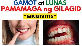  Gamot sa Pamamaga ng GILAGID o GINGIVITIS + Mga SINTOMAS | Masakit at MAGA na GILAGID, BAGANG