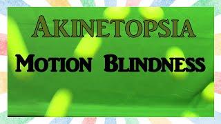 Motion Blindness - Akinetopsia. The Ways Your Brain Can Break