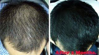 5 Most Effective Tips For Your Hair | Hair Care Bangla