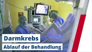 Darmkrebs - Diagnose, Therapie, Vorsorge