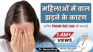 How To Treat Female Hair Loss | बाल झड़ना कैसे रोके? | Female Pattern Hair Loss | Causes & Treatment