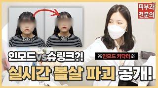 리프팅 끝판왕, 인모드 vs 슈링크! 충격적인 반반 시술 결과ㅣ노남경의 피부클래스