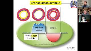 Ursachen von Bronchitis / Lungenentzündung einfach erklärt Folge 1