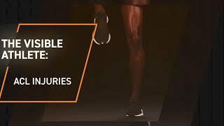 The Visible Athlete: Anterior Cruciate Ligament (ACL) Injury of the Knee