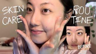 GLOWUP VLOG | Skincare Routine That Cleared My Face (ENG sub)