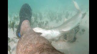 Bitten by a baby Lemon shark