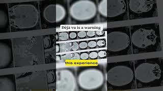 Déjà vu is warning for your future  #educationalvideo