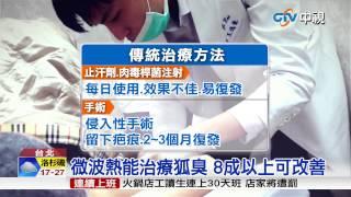 【中視新聞】治狐臭不開刀無疤痕 改善8成以上 20150714