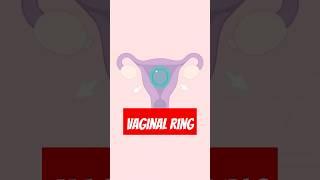 Vaginal Ring Birth Control Explained: How It Works, Effectiveness, & Side Effects #shorts