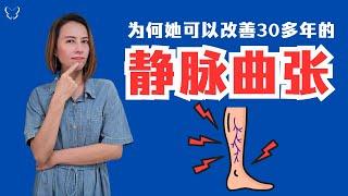 了解静脉曲张 | 为何她可以改善30多年的静脉曲张？About Varicose Veins | How can she improve?