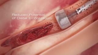 Capture Vascular Animation