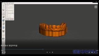 Meshmixer활용팁!)3shape트리오스, i500 등 구강스캔한 파일로 3d프린팅할 덴탈 모델빌더 제작방법!//How to add a base to a Dental Model