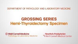 Grossing Hemi-Thyroidectomy Pathology Specimens | Department of Pathology and Laboratory Medicine