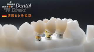 牙科德國Dental Direkt(DD)全瓷冠