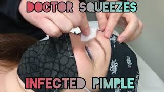 Abscessed Pimple Between Eyebrows & why it's dangerous | Infected Follicle