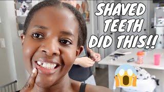 Shaved teeth then THIS HAPPENED!!