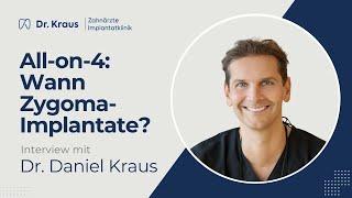  FAQ: Wann werden Zygoma-Implantate bei All-on-4 benötigt?  | Dr. Daniel Kraus