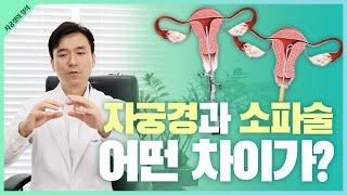 [자궁경의 정석] 2. 자궁경과 소파술 어떤 차이가?