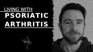 Living with Psoriatic Arthritis - Symptoms, Diagnosis, Impact on your life & Treatment