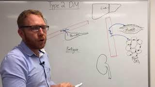 Type 2 Diabetes: Pathophysiology