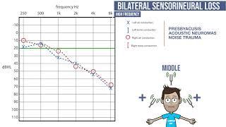 Audiograms