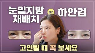 (ENG) 눈밑지 vs 하안검 수술, 정하는 기준이 뭘까요???  Under eye fat repositioning or a blepharoplasty?