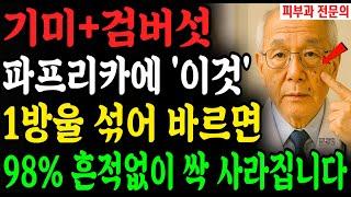 피부과 가지 마세요. 단돈 천원으로 20년 묵은 기미·검버섯·잡티 다 옅어졌습니다 85세 피부과 의사ㅣ노후건강ㅣ행복한노후ㅣ오디오북 | 삶의 지혜