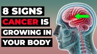 Don't Miss These 8 Early Cancer Signs – It Could Save You!