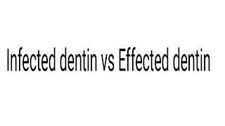 Infected Dentin vs Affected Dentin part 1