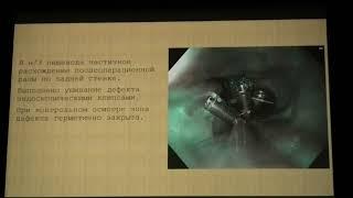 30 Первенство16 Фролов ЕА Разрыв пищевода ребенка 7 лет книжной полкой