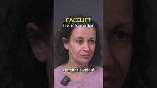 facelift transformation | Face Fitness | Face Yoga | Face Massage