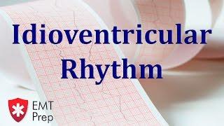 Idioventricular Rhythm ECG - EMTprep.com