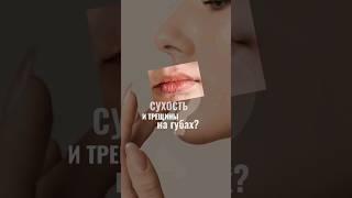 Сухость и трещины на губах? Топ 3 средств для губ. #губы #обзор #skincare #косметолог #goldapple