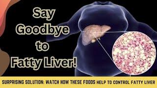 Struggling with Fatty Liver? Try These Foods for a Natural Fix!