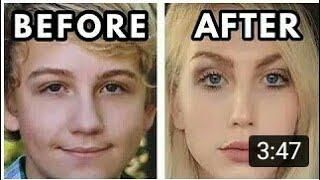 Amazing Before and After Male to Female Transition