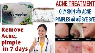 Dermadew soap | Dermadew acne Soap for acne, pimples, | Dermadew Soap Uses benefits review in hindi