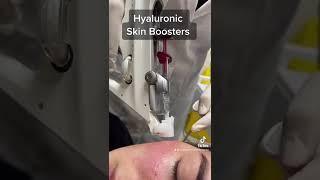 Skin Hydration Boosters | Newcastle Cosmetic Doctor | Dr performs Hyaluronic acid micro injections