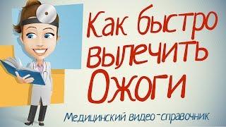 Ожоги лечение. Как лечить ожоги в домашних условиях.