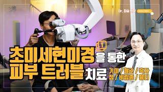 초미세현미경을 통한 #피부트러블 복합치료 1편 #닥터최승 #기미 #흑자 #비립종 #흉터 #검버섯 #혈관 #색소 #최승원장 #청담동피부과