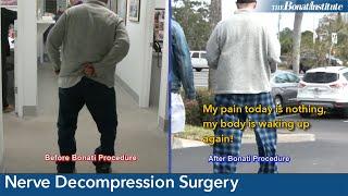 Nerve Decompression Surgery: Daryl’s Story