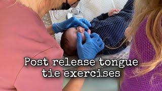Tongue tie post release stretches and exercises