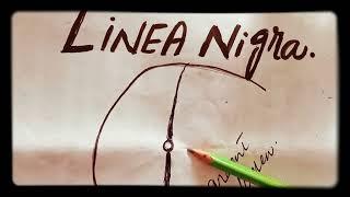 Linea nigra in pregnancy