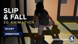 Slip and Fall - Injury Animation