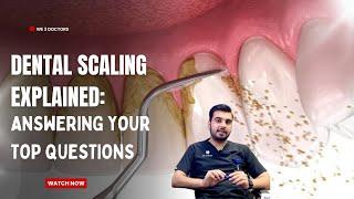 Answering your top questions about Dental Scaling | Teeth whitening | Oral Hygiene |