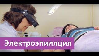 Электроэпиляция. Сделать электроэпиляцию в ЭпилСити.