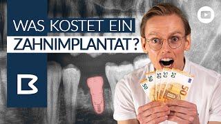 ZahnIMPLANTAT KOSTEN? Was muss ICH zahlen? Was zahlt die Krankenkasse? Alles GENAU erklärt!