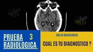 PONTE A PRUEBA 3 (CUAL ES TU DIAGNOSTICO? )